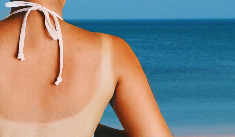 How to Regenerate Skin and Hair Damaged by the Sun