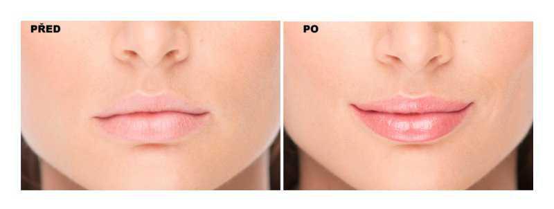 FacEvolution LipPlus Booster makeup