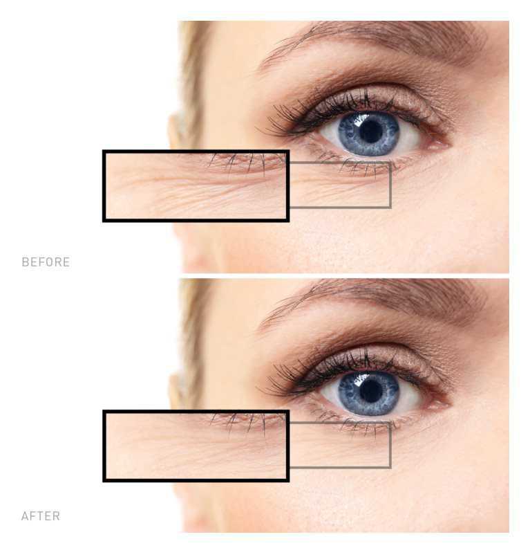 Saffee Advanced Wrinkle Erasing Set facial skin care